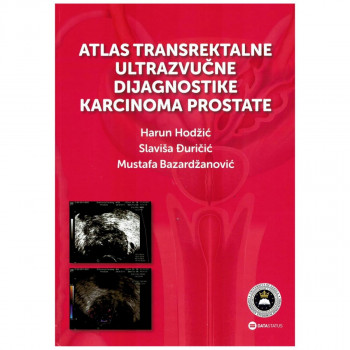 Atlas transrektalne ultrazvučne dijagnostike karcinoma prostate 