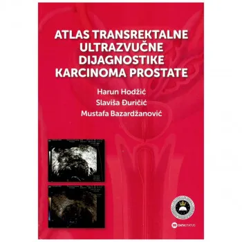 Atlas transrektalne ultrazvučne dijagnostike karcinoma prostate 