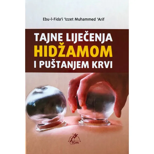 Tajne liječenja hidžamom i puštanjem krvi 