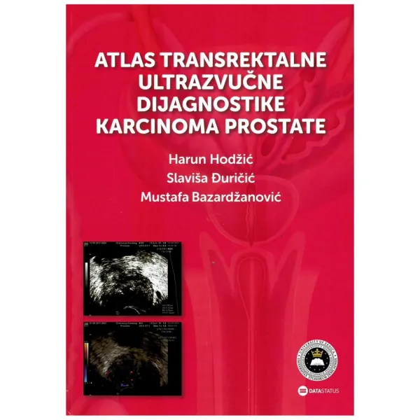 Atlas transrektalne ultrazvučne dijagnostike karcinoma prostate 