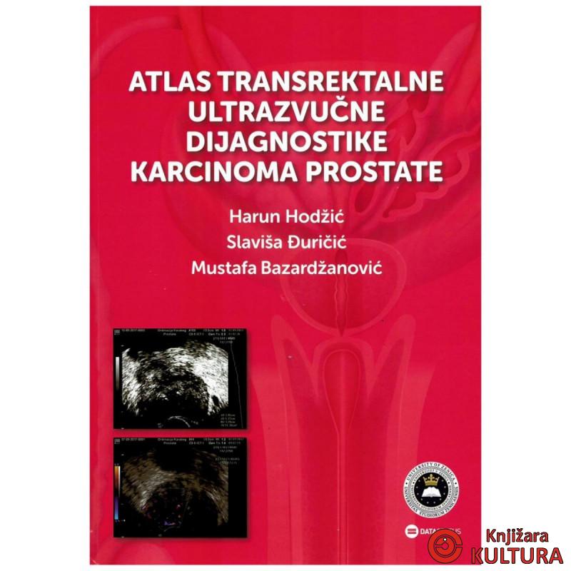 Atlas transrektalne ultrazvučne dijagnostike karcinoma prostate 