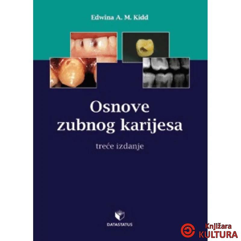 OSNOVI ZUBNOG KARIJESA 